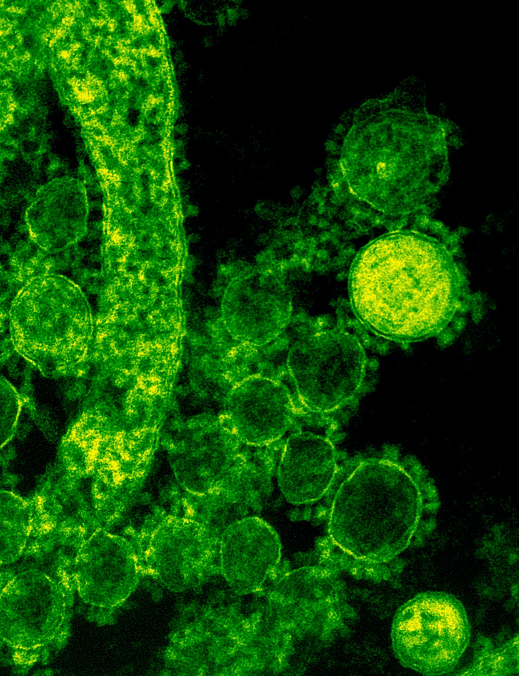 Cómo prevenir el virus del papiloma humano: la respuesta puede sorprenderte